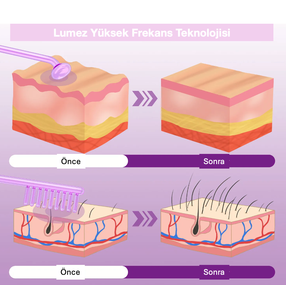 Lumez Cilt Bakım Cihazı