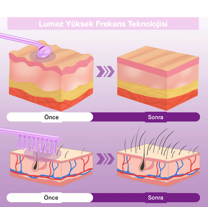 Lumez Cilt Bakım Cihazı